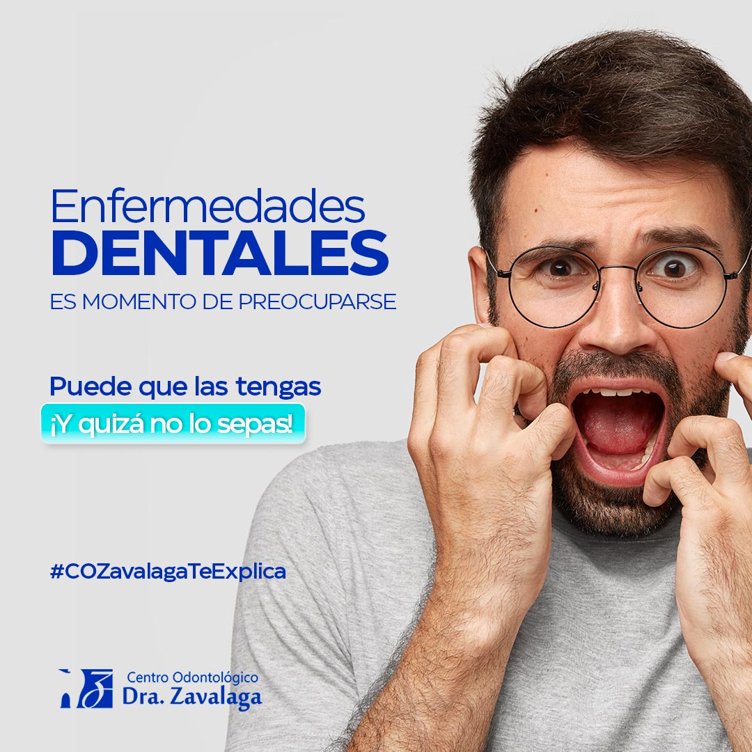 Enfermedades Dentales Es Momento De Preocuparse Centro Odontológico Dra Zavalaga 8424